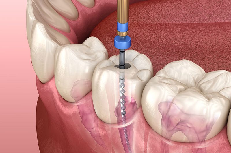 Puthanathani Dental Clinic