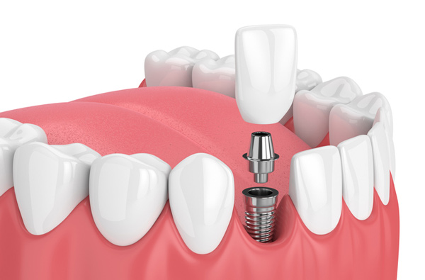 Puthanathani Dental Clinic